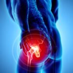 hip-surgery-p4q2rxd4pf1dn0f1mp1ya00g8gf374skrmfiwxedm8