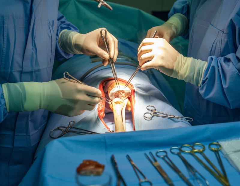 a-clinical-photograph-of-an-orthopedic-s_jjO76V4FS5OkJVkaQ58kuw_LDo6XgkTSz-HamyOx65B3A a-clinical-photograph-of-an-orthopedic-s_jjO76V4FS5OkJVkaQ58kuw_LDo6XgkTSz-HamyOx65B3A